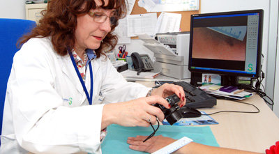 El programa de Teledermatología del SESCAM reduce el tiempo de diagnóstico y tratamiento en el Área de Talavera 