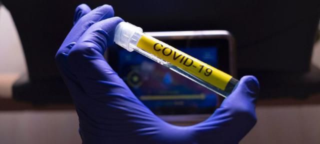 COVID-19 | Alemania registra su mayor cifra de contagios de coronavirus desde finales de abril