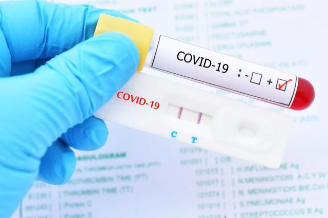 COVID-19 | Investigan un posible brote de coronavirus en un campamento en Riópar