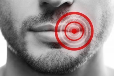 7 de cada 10 españoles podría desarrollar herpes labial