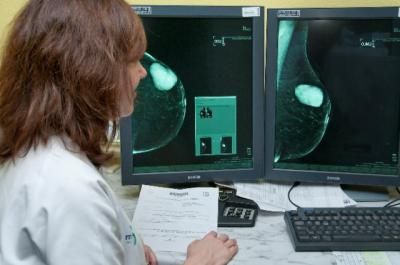 El 73% de las mujeres citadas por SESCAM en Talavera se hicieron las pruebas de detección de cáncer de mama