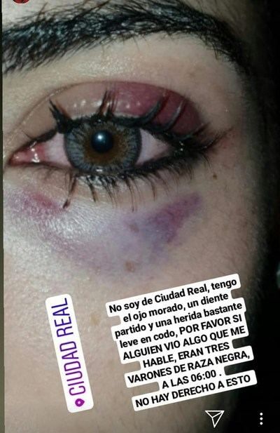 Policía Local auxilia y lleva al hospital a una chica agredida por otro joven que intentó besarla