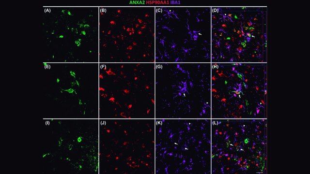 Esta investigación de la UCLM podría mejorar el diagnóstico y tratamiento del Alzhéimer