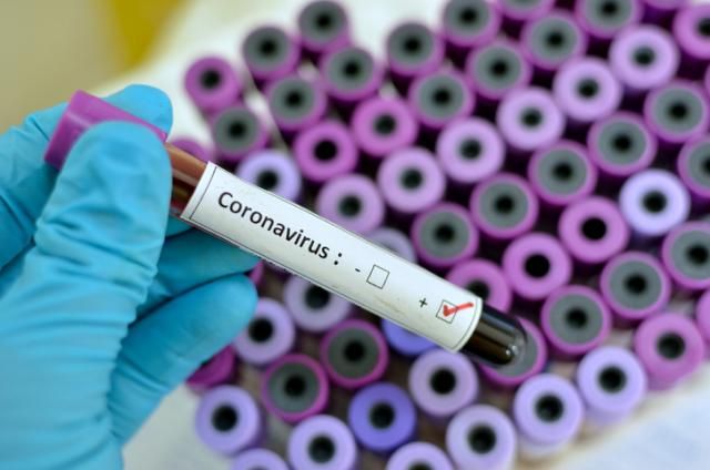 CORONAVIRUS | CLM registra 315 casos más hasta los 2.780