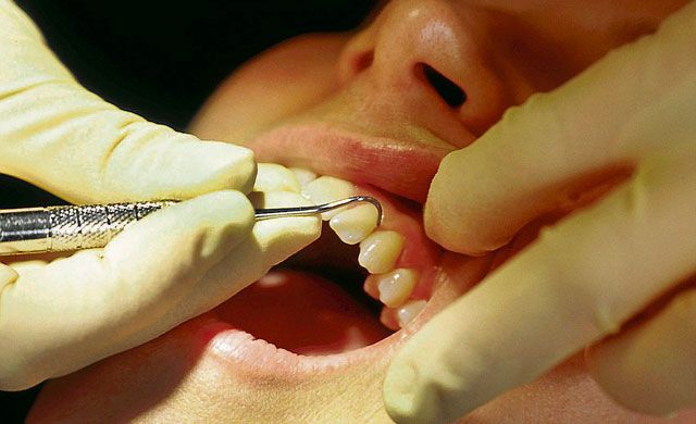 Condenan a dos protésicos en Talavera por hacer trabajos de dentistas