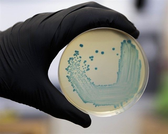 Food Safety Pathogen Listeria Monocytogenes Isolated On Agar From A Food Sample.RECTORADO UNIVERSIDAD COMPLUTENSE