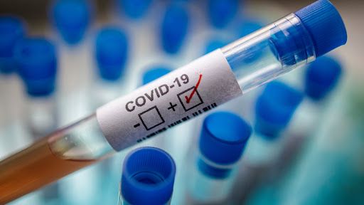 CORONAVIRUS | Cambia el perfil de nuevos contagios por Covid en CLM: jóvenes y asintomáticos