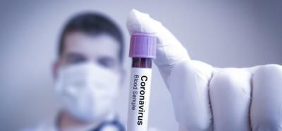 CORONAVIRUS | Test rápidos de detección del Covid-19 para Talavera